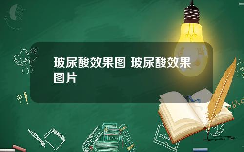 玻尿酸效果图 玻尿酸效果图片