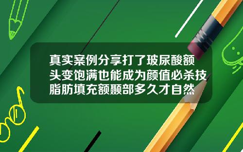 真实案例分享打了玻尿酸额头变饱满也能成为颜值必杀技脂肪填充额颞部多久才自然