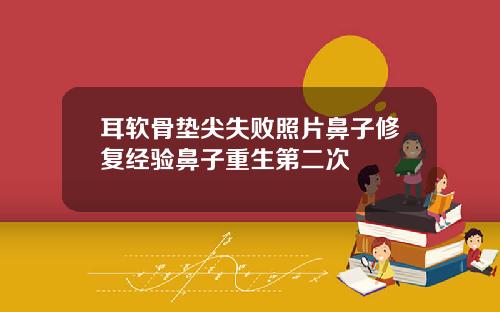 耳软骨垫尖失败照片鼻子修复经验鼻子重生第二次