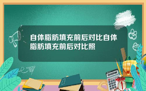 自体脂肪填充前后对比自体脂肪填充前后对比照