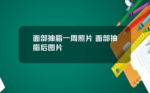 面部抽脂一周照片 面部抽脂后图片