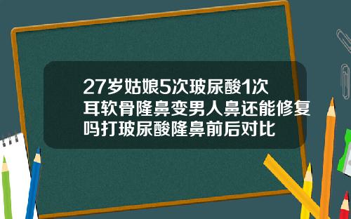 27岁姑娘5次玻尿酸1次耳软骨隆鼻变男人鼻还能修复吗打玻尿酸隆鼻前后对比