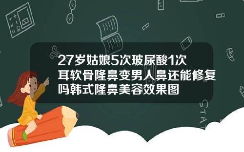 27岁姑娘5次玻尿酸1次耳软骨隆鼻变男人鼻还能修复吗韩式隆鼻美容效果图