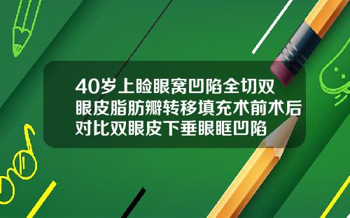 40岁上睑眼窝凹陷全切双眼皮脂肪瓣转移填充术前术后对比双眼皮下垂眼眶凹陷