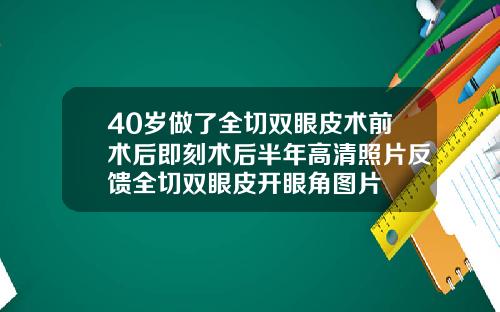 40岁做了全切双眼皮术前术后即刻术后半年高清照片反馈全切双眼皮开眼角图片