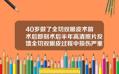 40岁做了全切双眼皮术前术后即刻术后半年高清照片反馈全切双眼皮过程中损伤严重能恢复吗