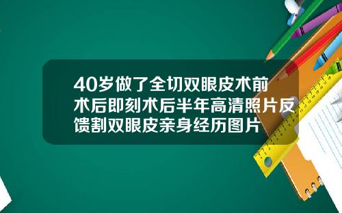 40岁做了全切双眼皮术前术后即刻术后半年高清照片反馈割双眼皮亲身经历图片