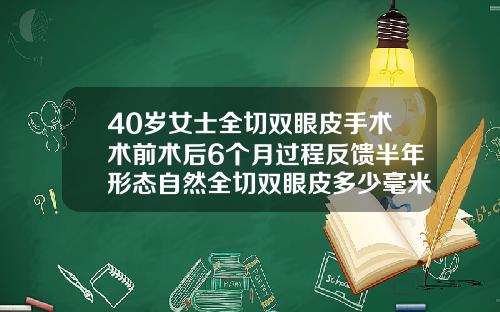 40岁女士全切双眼皮手术术前术后6个月过程反馈半年形态自然全切双眼皮多少毫米最自然好看