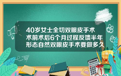 40岁女士全切双眼皮手术术前术后6个月过程反馈半年形态自然双眼皮手术要做多久