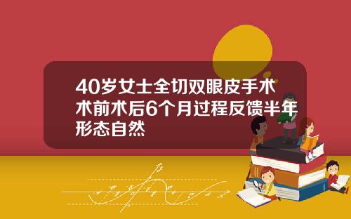 40岁女士全切双眼皮手术术前术后6个月过程反馈半年形态自然