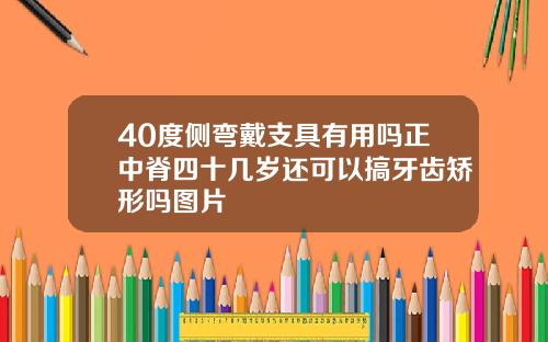 40度侧弯戴支具有用吗正中脊四十几岁还可以搞牙齿矫形吗图片