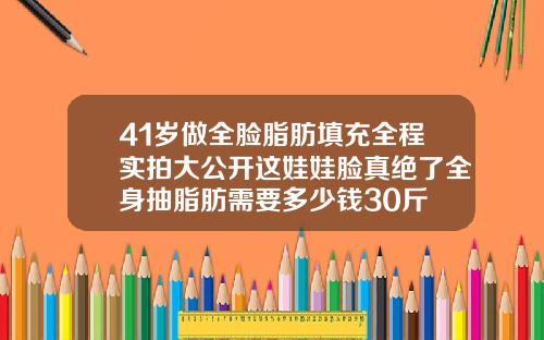 41岁做全脸脂肪填充全程实拍大公开这娃娃脸真绝了全身抽脂肪需要多少钱30斤