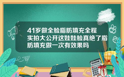 41岁做全脸脂肪填充全程实拍大公开这娃娃脸真绝了脂肪填充做一次有效果吗