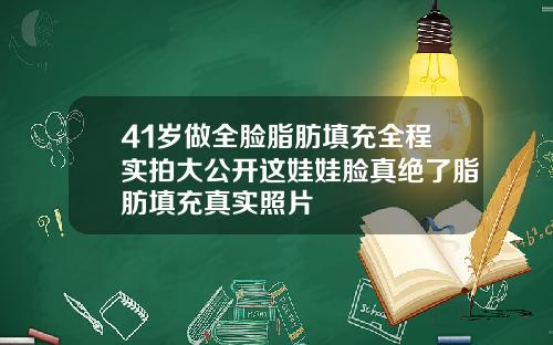 41岁做全脸脂肪填充全程实拍大公开这娃娃脸真绝了脂肪填充真实照片