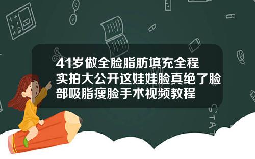 41岁做全脸脂肪填充全程实拍大公开这娃娃脸真绝了脸部吸脂瘦脸手术视频教程