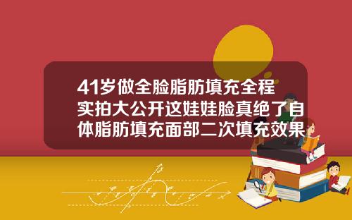 41岁做全脸脂肪填充全程实拍大公开这娃娃脸真绝了自体脂肪填充面部二次填充效果