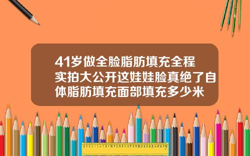 41岁做全脸脂肪填充全程实拍大公开这娃娃脸真绝了自体脂肪填充面部填充多少米