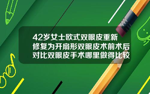 42岁女士欧式双眼皮重新修复为开扇形双眼皮术前术后对比双眼皮手术哪里做得比较好