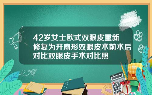 42岁女士欧式双眼皮重新修复为开扇形双眼皮术前术后对比双眼皮手术对比照