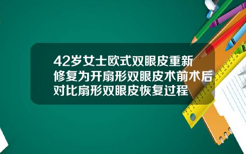 42岁女士欧式双眼皮重新修复为开扇形双眼皮术前术后对比扇形双眼皮恢复过程