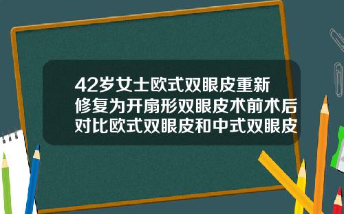 42岁女士欧式双眼皮重新修复为开扇形双眼皮术前术后对比欧式双眼皮和中式双眼皮的区别