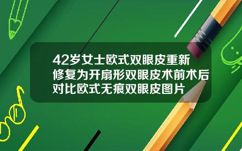 42岁女士欧式双眼皮重新修复为开扇形双眼皮术前术后对比欧式无痕双眼皮图片