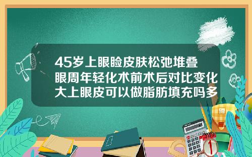 45岁上眼睑皮肤松弛堆叠眼周年轻化术前术后对比变化大上眼皮可以做脂肪填充吗多少钱