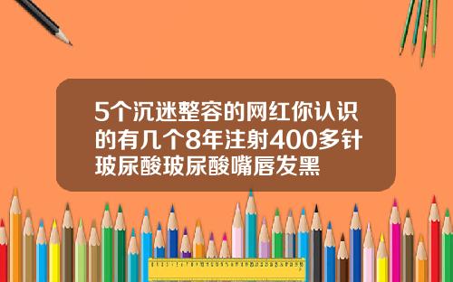 5个沉迷整容的网红你认识的有几个8年注射400多针玻尿酸玻尿酸嘴唇发黑