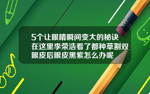 5个让眼睛瞬间变大的秘诀在这里李荣浩看了都种草割双眼皮后眼皮黑紫怎么办呢