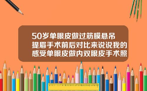 50岁单眼皮做过筋膜悬吊提眉手术前后对比来说说我的感受单眼皮做内双眼皮手术照片