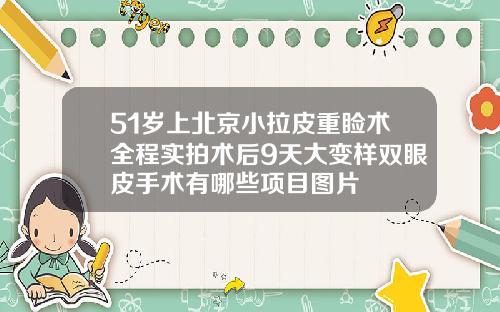 51岁上北京小拉皮重睑术全程实拍术后9天大变样双眼皮手术有哪些项目图片