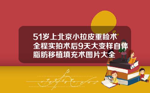 51岁上北京小拉皮重睑术全程实拍术后9天大变样自体脂肪移植填充术图片大全