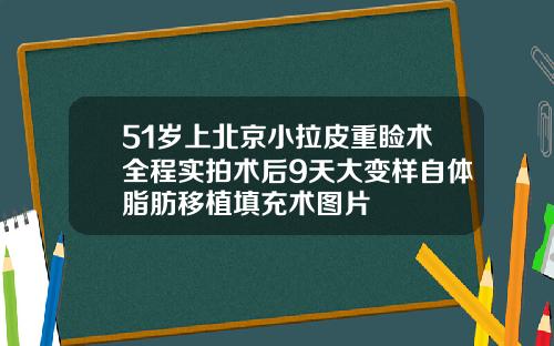 51岁上北京小拉皮重睑术全程实拍术后9天大变样自体脂肪移植填充术图片