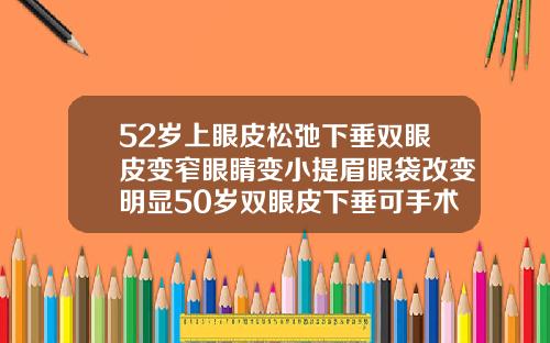 52岁上眼皮松弛下垂双眼皮变窄眼睛变小提眉眼袋改变明显50岁双眼皮下垂可手术吗图片
