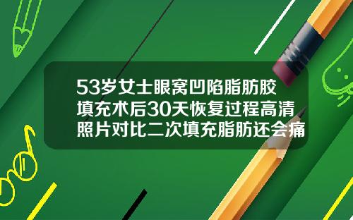 53岁女士眼窝凹陷脂肪胶填充术后30天恢复过程高清照片对比二次填充脂肪还会痛吗多久