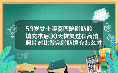 53岁女士眼窝凹陷脂肪胶填充术后30天恢复过程高清照片对比做完脂肪填充怎么才能快速消肿