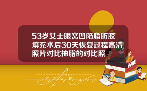 53岁女士眼窝凹陷脂肪胶填充术后30天恢复过程高清照片对比抽脂的对比照