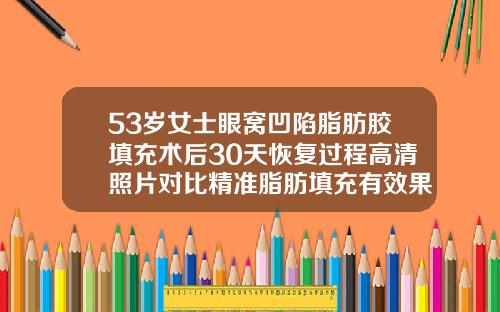 53岁女士眼窝凹陷脂肪胶填充术后30天恢复过程高清照片对比精准脂肪填充有效果吗