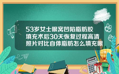 53岁女士眼窝凹陷脂肪胶填充术后30天恢复过程高清照片对比自体脂肪怎么填充眼窝