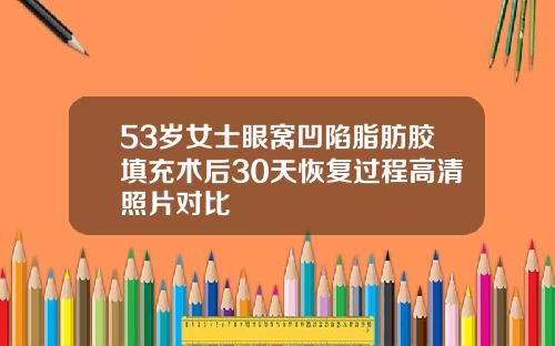 53岁女士眼窝凹陷脂肪胶填充术后30天恢复过程高清照片对比