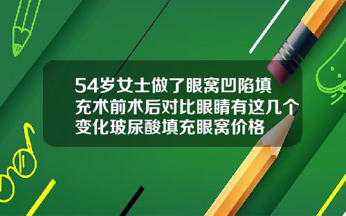 54岁女士做了眼窝凹陷填充术前术后对比眼睛有这几个变化玻尿酸填充眼窝价格