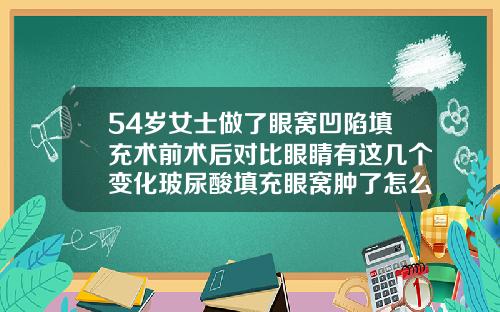 54岁女士做了眼窝凹陷填充术前术后对比眼睛有这几个变化玻尿酸填充眼窝肿了怎么办