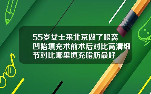 55岁女士来北京做了眼窝凹陷填充术前术后对比高清细节对比哪里填充脂肪最好