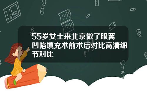 55岁女士来北京做了眼窝凹陷填充术前术后对比高清细节对比