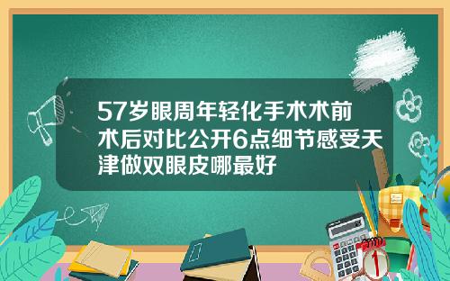 57岁眼周年轻化手术术前术后对比公开6点细节感受天津做双眼皮哪最好