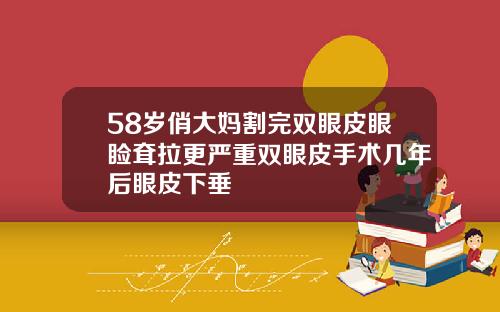 58岁俏大妈割完双眼皮眼睑耷拉更严重双眼皮手术几年后眼皮下垂