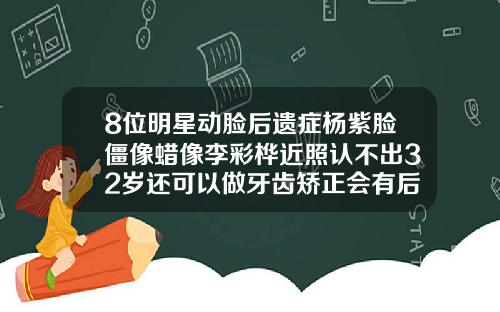 8位明星动脸后遗症杨紫脸僵像蜡像李彩桦近照认不出32岁还可以做牙齿矫正会有后遗症吗