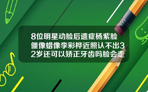 8位明星动脸后遗症杨紫脸僵像蜡像李彩桦近照认不出32岁还可以矫正牙齿吗脸会走形吗
