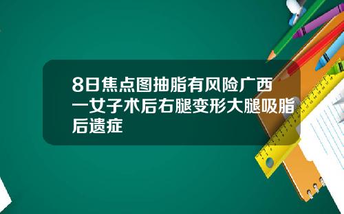 8日焦点图抽脂有风险广西一女子术后右腿变形大腿吸脂后遗症