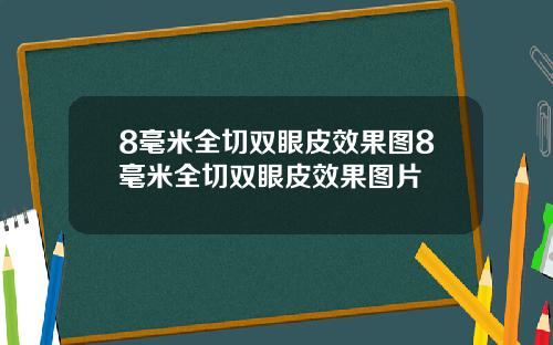 8毫米全切双眼皮效果图8毫米全切双眼皮效果图片